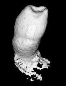 成人能长新牙齿吗视频,新牙齿生长的可能性