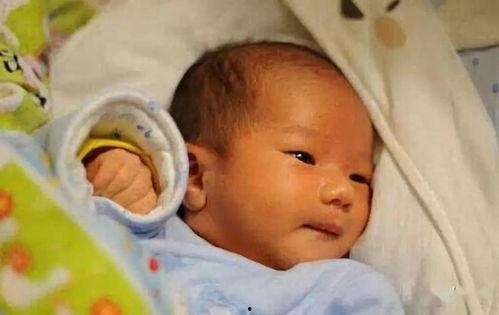 成人黄疸案例视频大全,深度解读黄疸成因与治疗策略